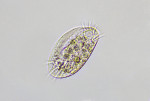 protozoa-marine-euplotes.jpg